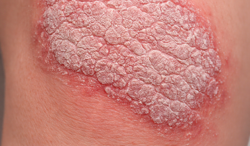 Allgemeine Dermatologie